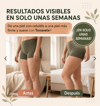 Tonavele® - Masajeador Anticelulítico